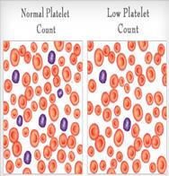 Platelets During Dengue Fever